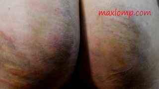 Blonde is Fixed to Post and Caned on Ass