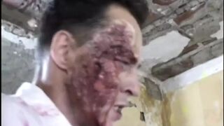 Absolute LATEX !!! - TRAUMA #02