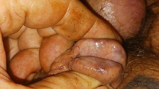 Inflated Badder with Pissing and Needle in Cock Gland Inflation Pain That Is Pleasure Bisexual Male.