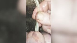 Inflated Badder with Pissing and Needle in Cock Gland Inflation Pain That Is Pleasure Bisexual Male.